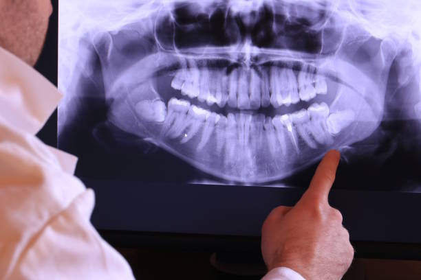 Best Emergency Treatment for Dental Infections or Abscesses in Bay Village, OH