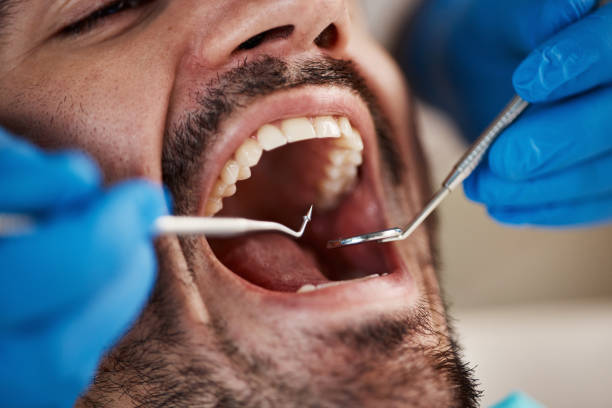 Best Emergency Gum Treatment in Bay Village, OH